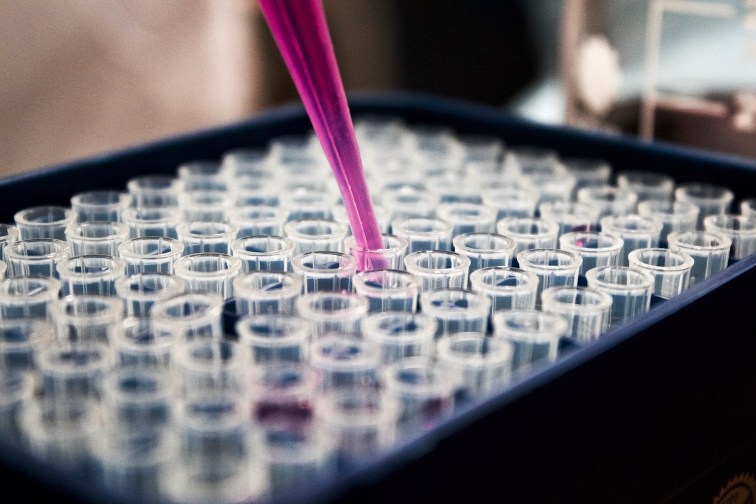 Por Que Escolher a Carreira de Medical Laboratory Scientist
